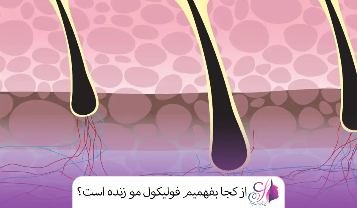 از کجا بفهمیم فولیکول مو زنده است؟