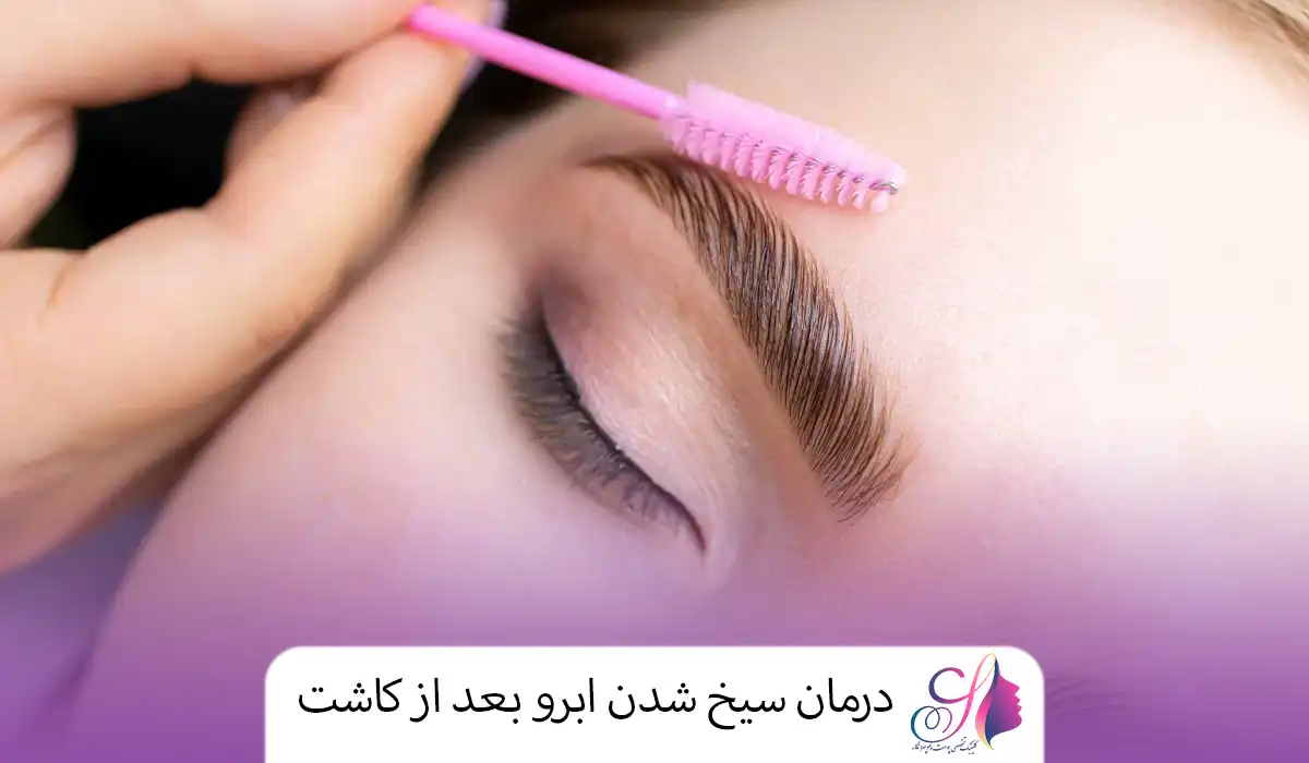 درمان سیخ شدن ابرو بعد از کاشت
