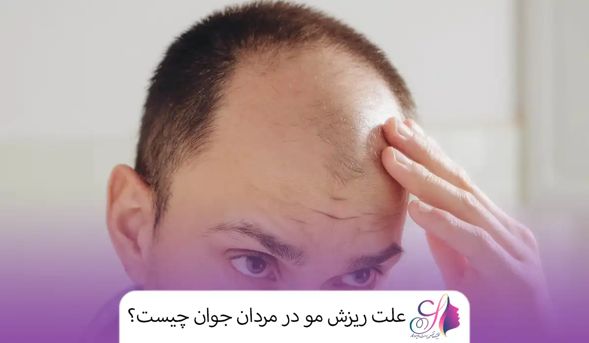 علت ریزش مو در مردان جوان چیست؟
