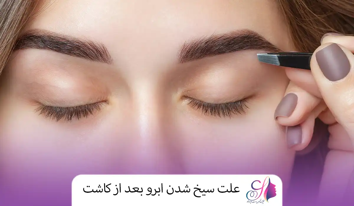 علت سیخ شدن ابرو بعد از کاشت
