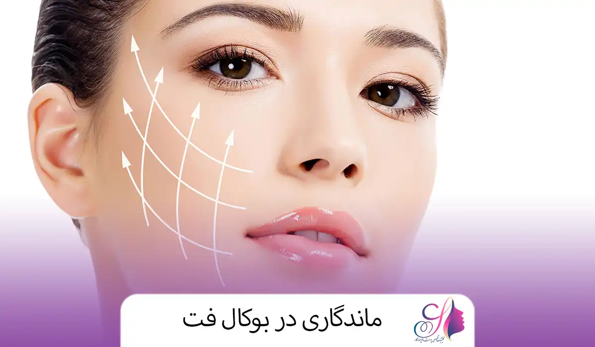 ماندگاری در بوکال فت