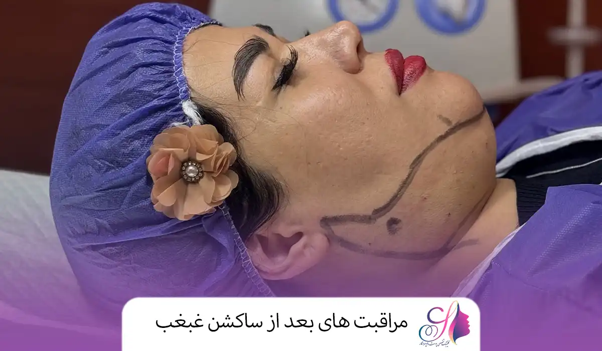 مراقبت‌ های بعد از ساکشن غبغب
