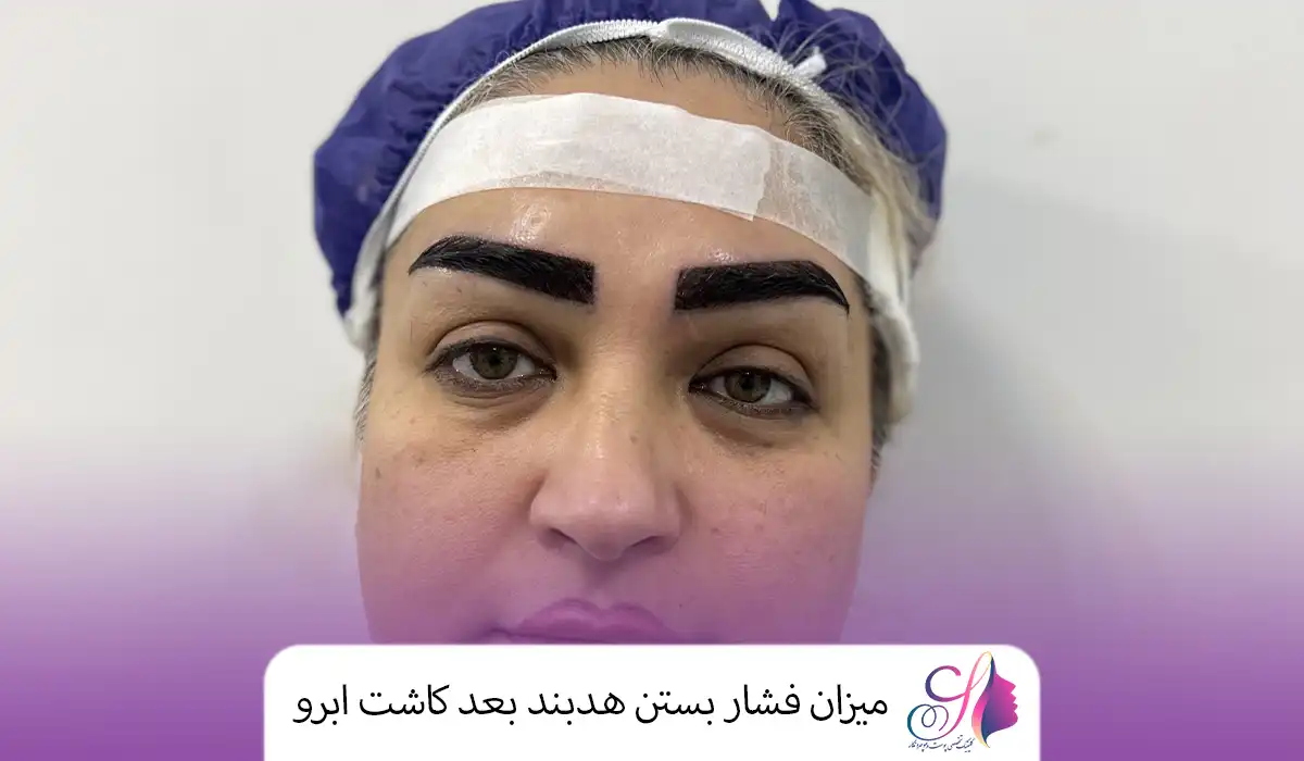 میزان فشار بستن هدبند بعد کاشت ابرو