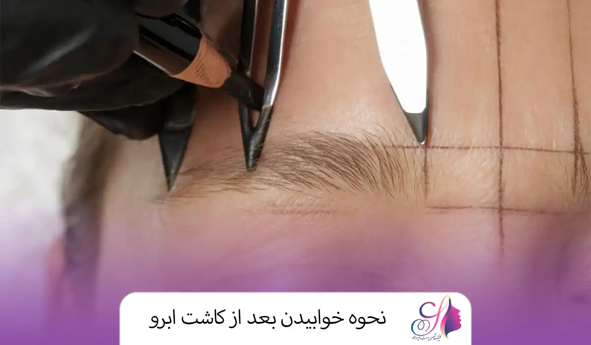 نحوه خوابیدن بعد از کاشت ابرو