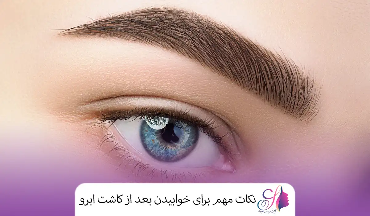 نکات مهم برای خوابیدن بعد از کاشت ابرو