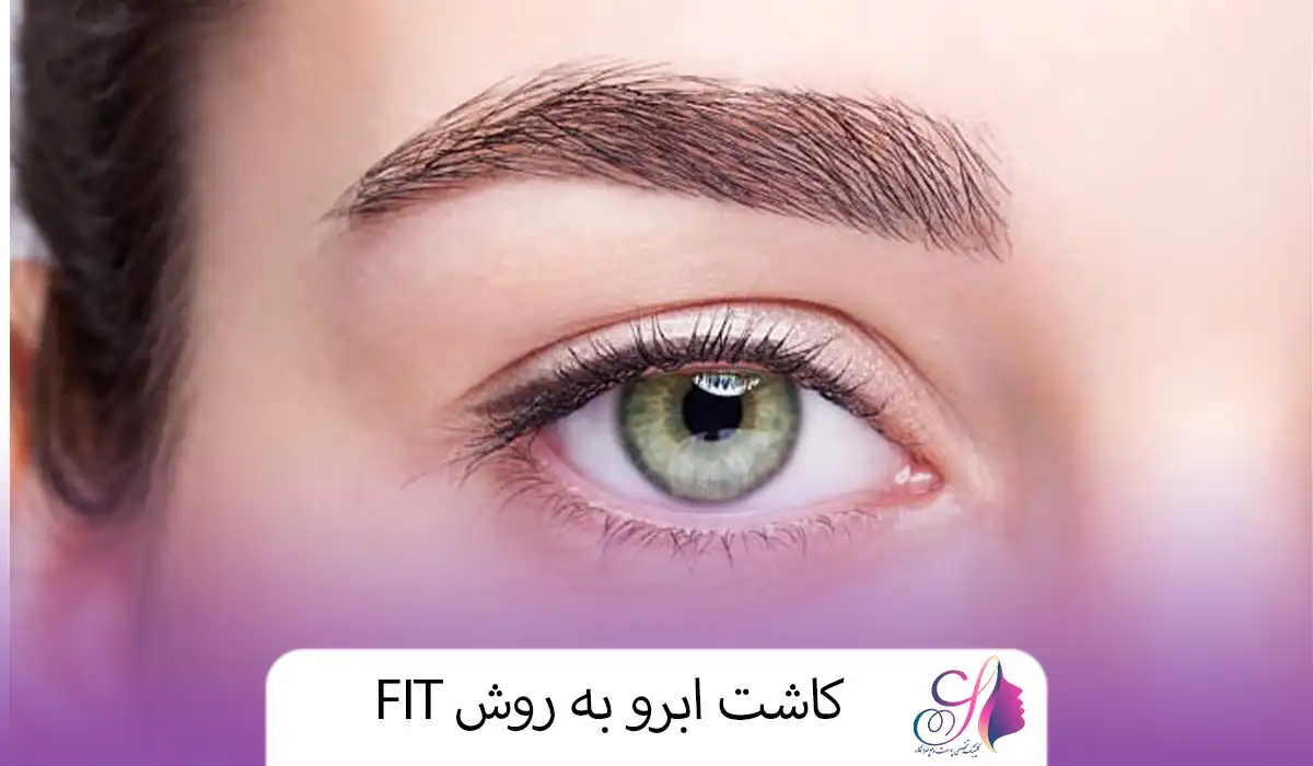 کاشت ابرو به روش FIT
