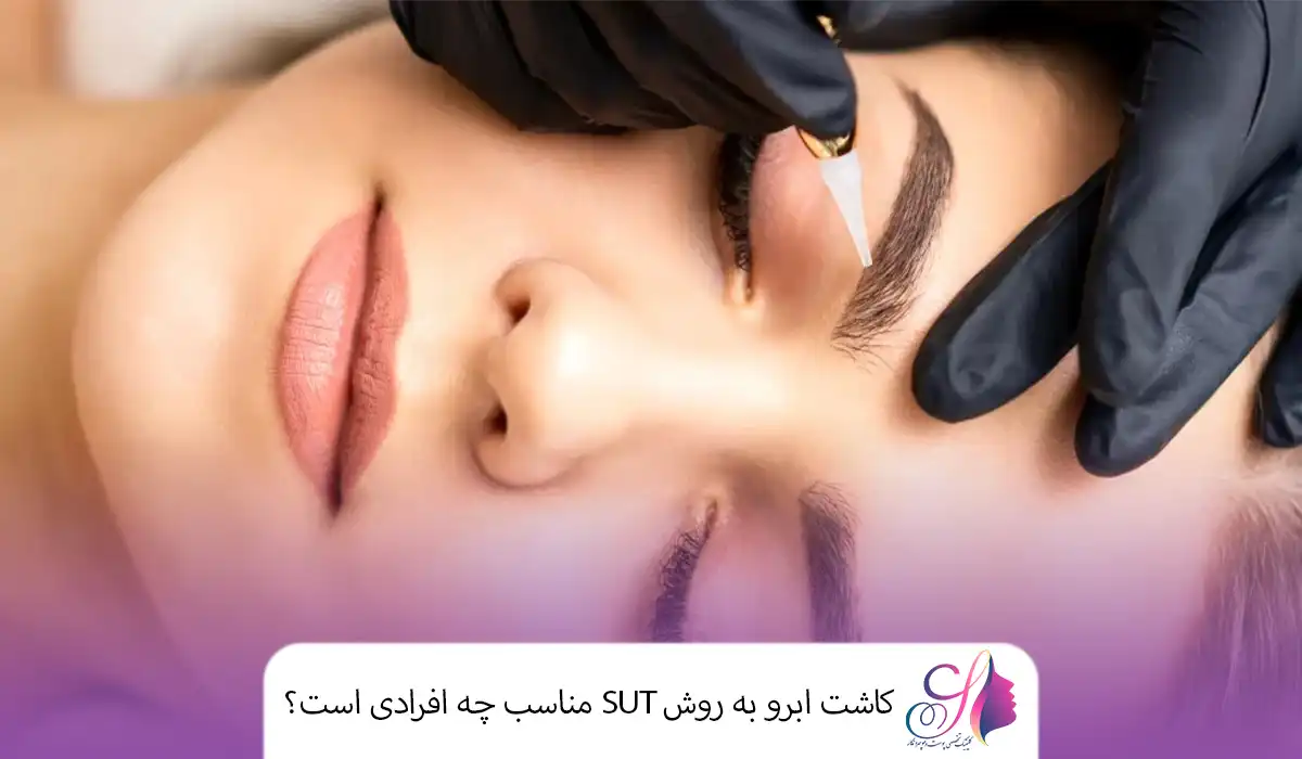 کاشت ابرو به روش SUT‌ مناسب چه افرادی است؟