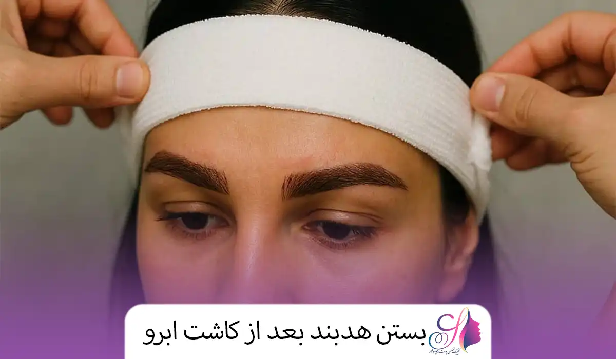 بستن هدبند بعد از کاشت ابرو
