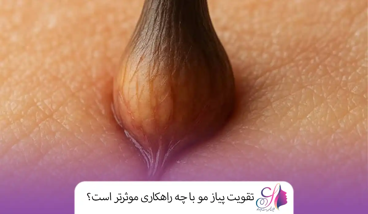 تقویت پیاز مو با چه راهکاری موثرتر است؟