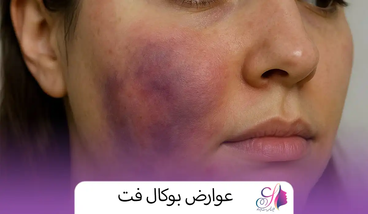 عوارض بوکال فت