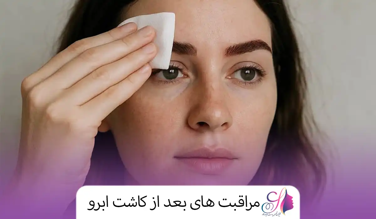 مراقبت های بعد از کاشت ابرو