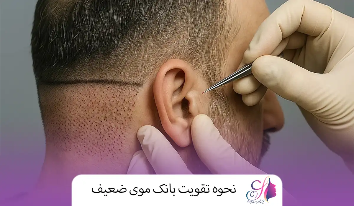 نحوه تقویت بانک موی ضعیف