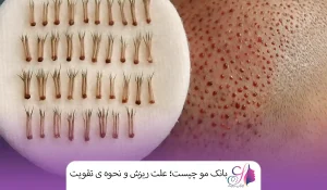 بانک مو چیست؛ علت ریزش و نحوه ی تقویت