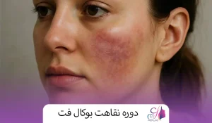 دوره نقاهت بوکال فت
