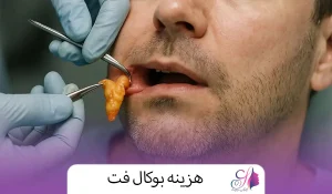 هزینه بوکال فت