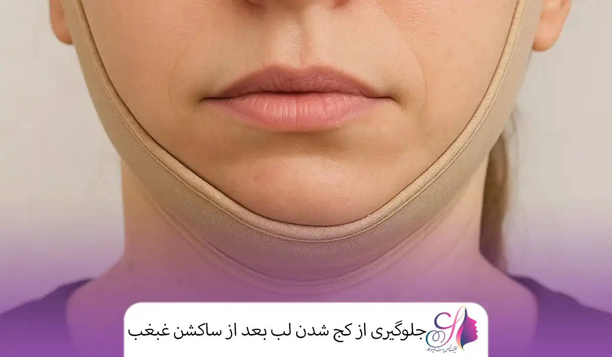 جلوگیری از کج شدن لب بعد از ساکشن غبغب